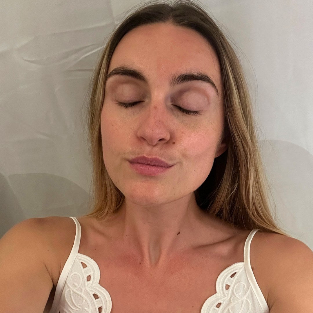 Skin tone at month three